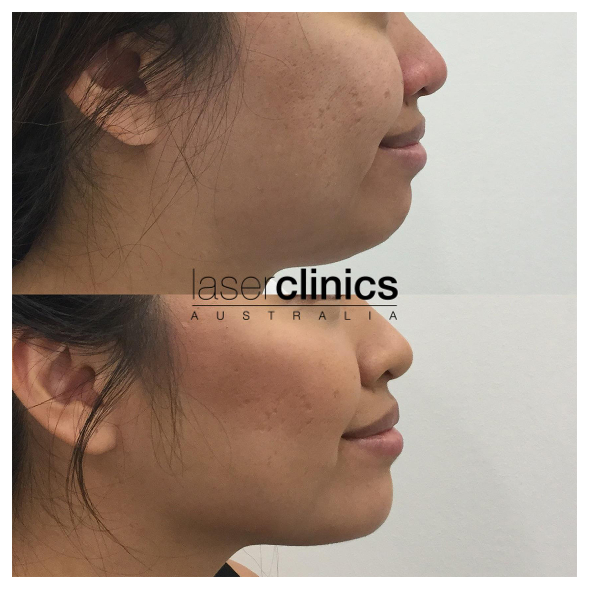 Laser Clinics Australia Trusted Laser Skin Care Cosmetic Clinic