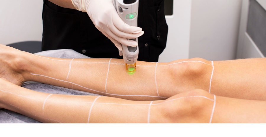 Benefits of Full Body Laser Hair Removal | Laser Clinics NZ