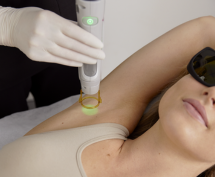 Laser Hair Removal