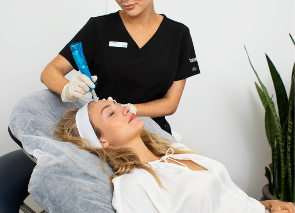 Skin Needling treatment.png