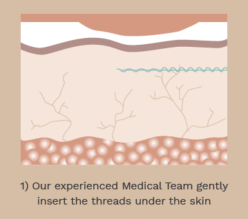 PDO Threads_how it works_359 x 318px final 1.jpg