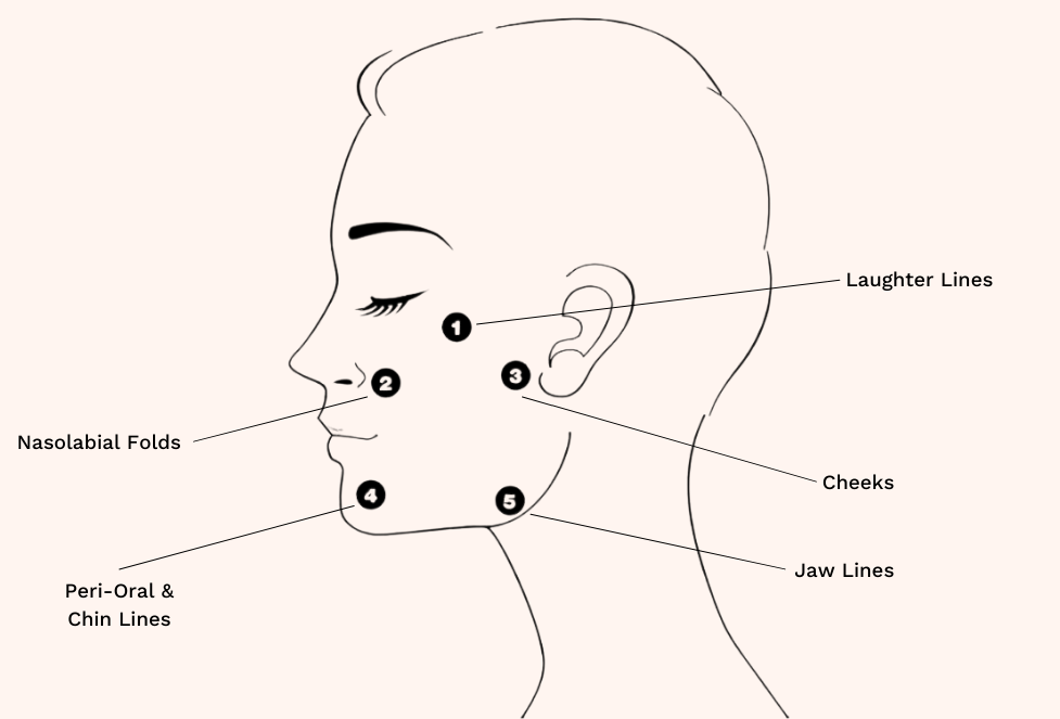 Profhilo Areas We Treat (1) (1).png