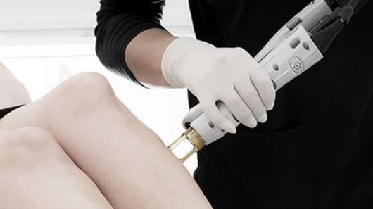 Laser Hair Removal for Men and Women | Laser Clinics New Zealand