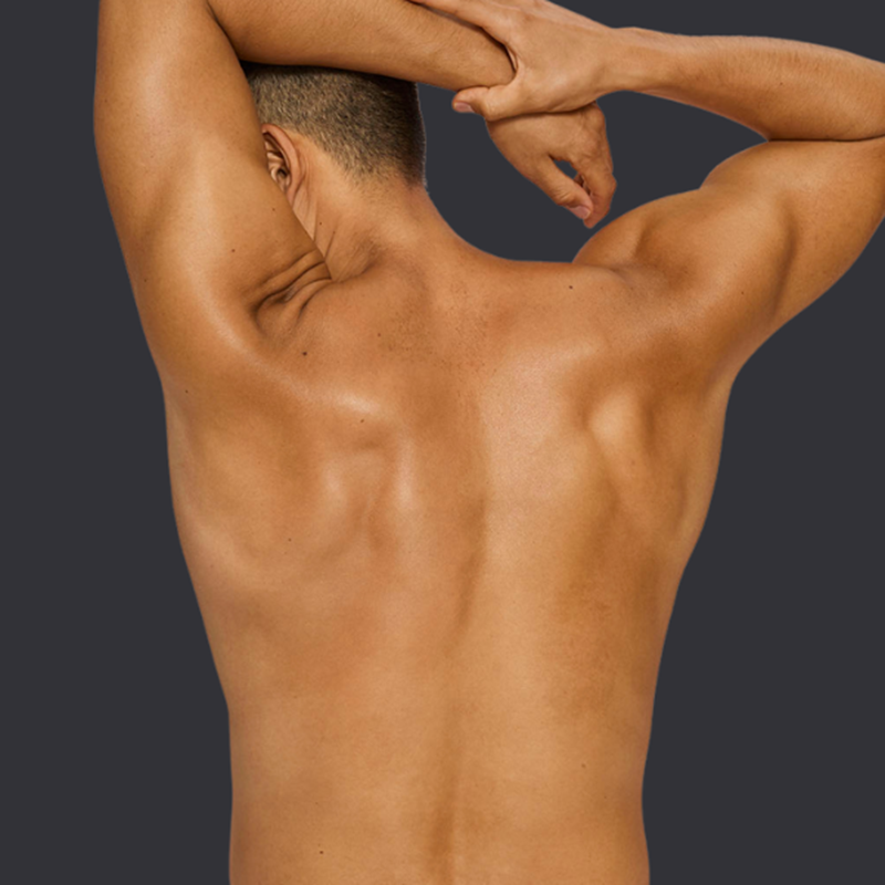 Stubborn Fat is Calling