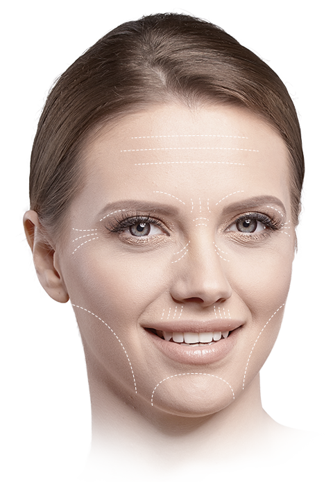 Wrinkle Treatment Areas