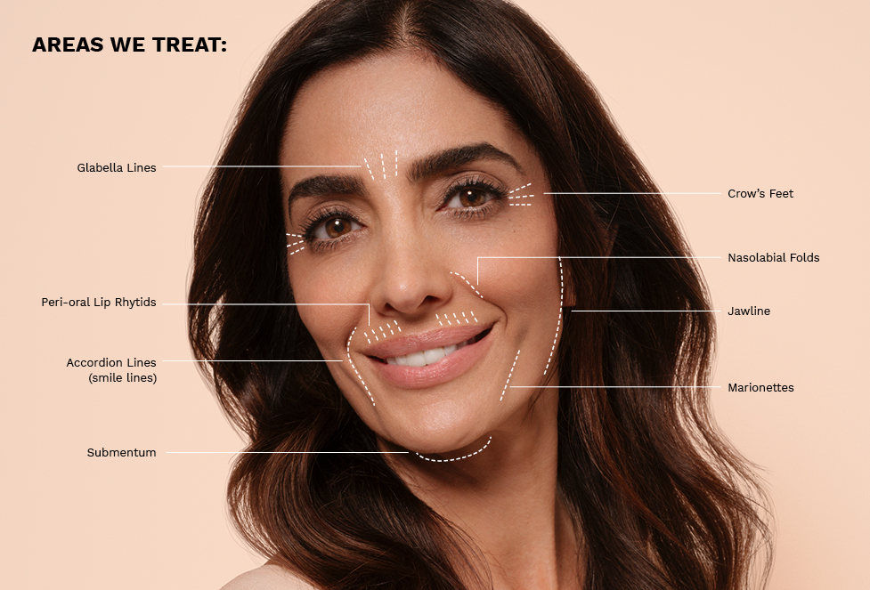 mono thread_treatment areas_977px x 663px.jpg